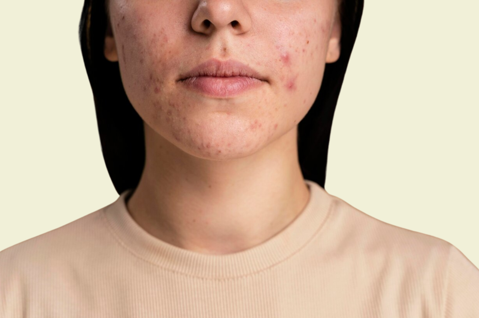 Ciltteki Kızarıklıklar ve İrritasyon: Hızlı Çözüm Yolları